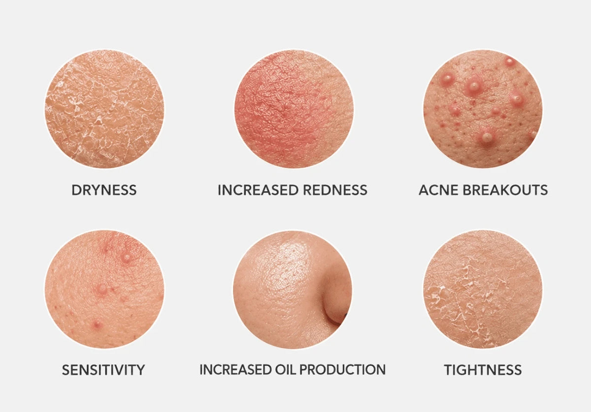 The Truth About Over-Exfoliation