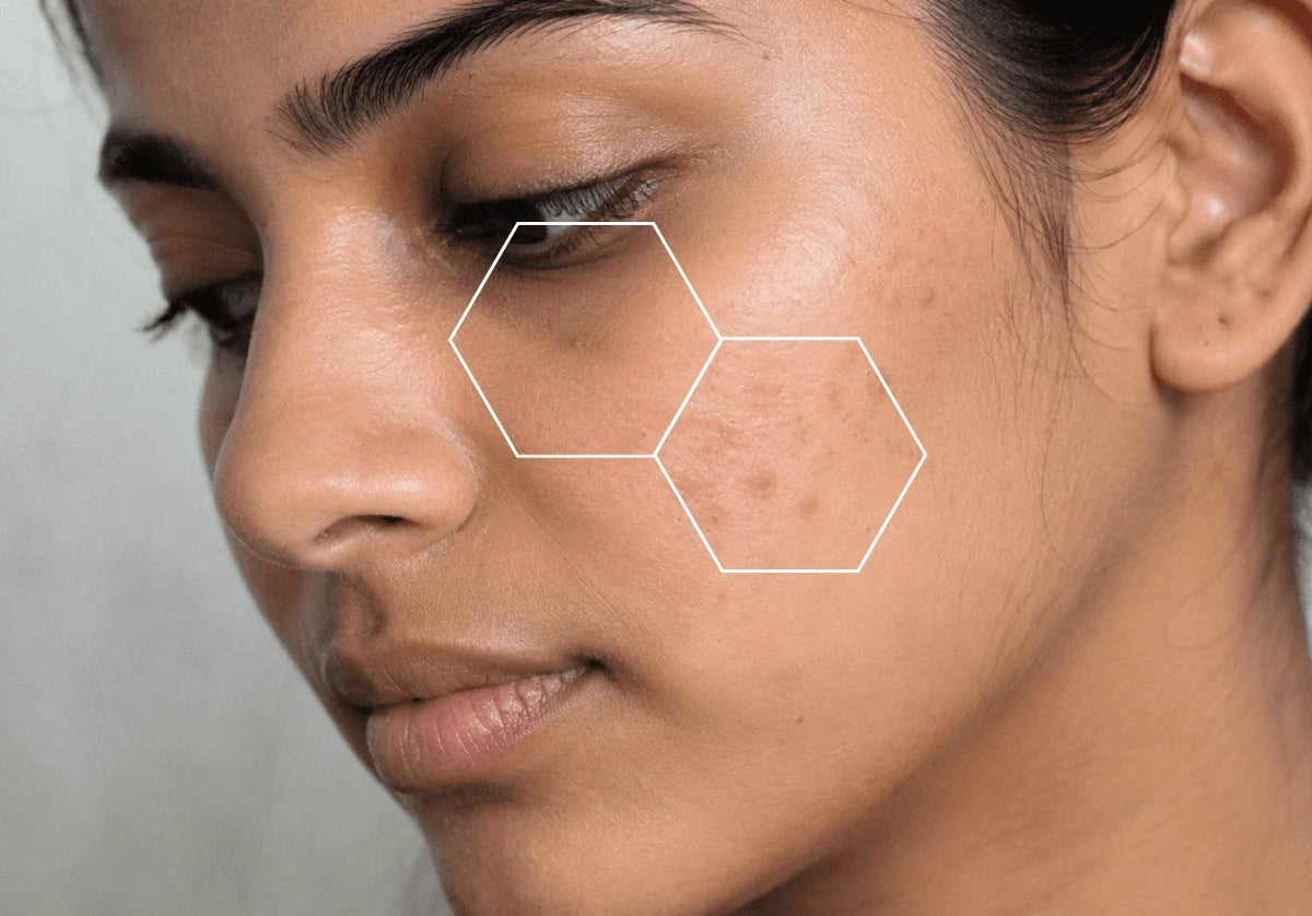 Reduce Pigmentation