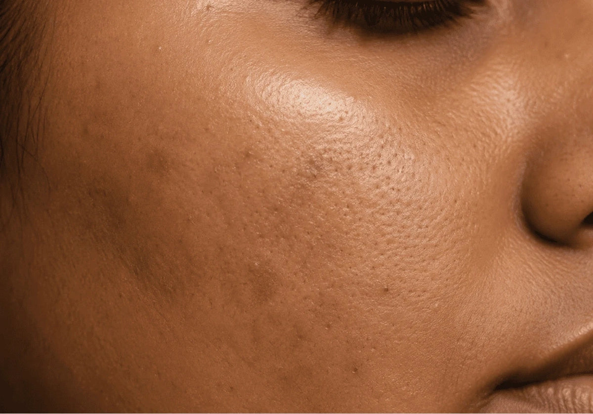 Skin Barrier Explained
